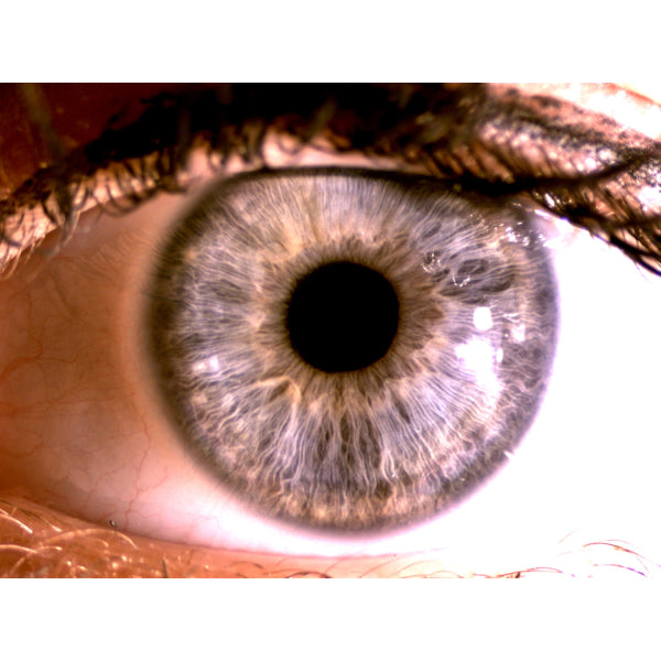 SISTEMA DI ACQUISIZIONE DI IMMAGINI PER LAMPADA A FESSURA (TELECAMERA DIGITALE)